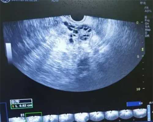 深圳三代试管选男孩南昌地下代生小孩移植后能上厕所吗？